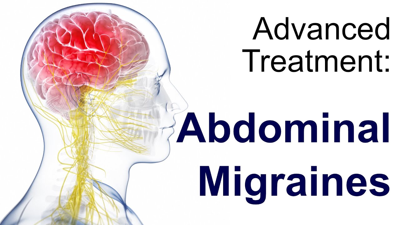 Abdominal Migraine Treatments