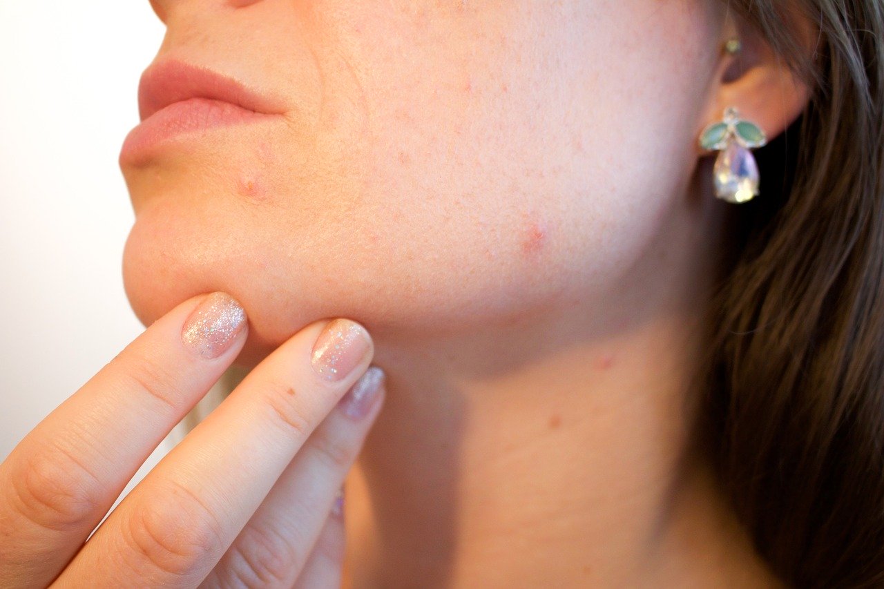 Discover These Common Skin Issues to Be Aware of