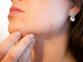 Discover These Common Skin Issues to Be Aware of